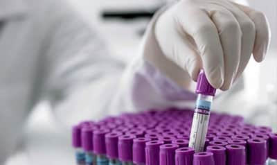 Микробиологија